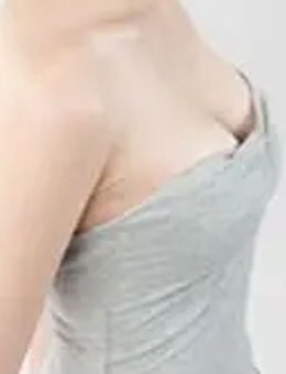 韩国BR整形外科医院-乳房下垂矫正手术案例