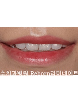 -韩国牙齿修复医院排名，韩国SU牙科名气高上榜啦！