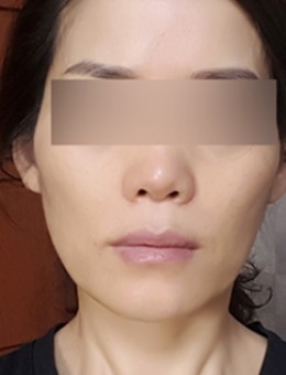 韩国seroi整形医院-面部皮肤治疗图