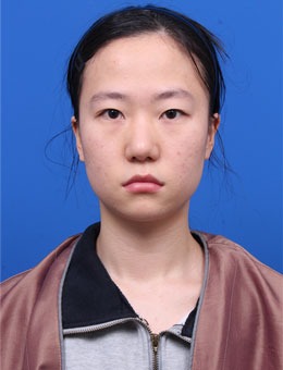 韩国思凯琦整形外科做双眼皮手术超赞！