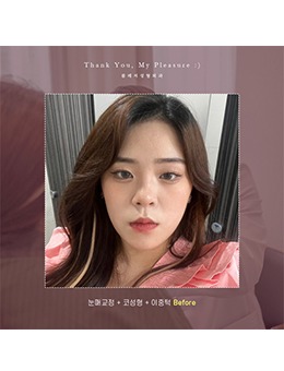 真人分享,在韩国美舒雅整形做眼鼻整形是个什么体验?