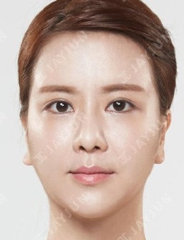 全臉整形又瘦又美，韓國jayjun整形面部整形照片來了！