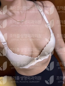 韩国隆胸哪家医院做的好？网友推荐韩国喜悦整形建议大家做功课！