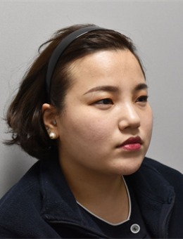 弘大凯特kate皮肤科皮肤焕新计划!施术后皮肤透亮又紧致~