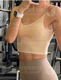 韩国喜悦整形隆胸技术贼好！韩女对这家整形医院的评价非常高！