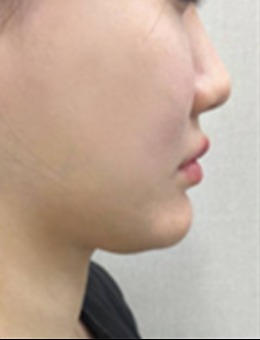 韩国夏恩医院很正规！在韩国口碑也是相当好的一家医院哦！