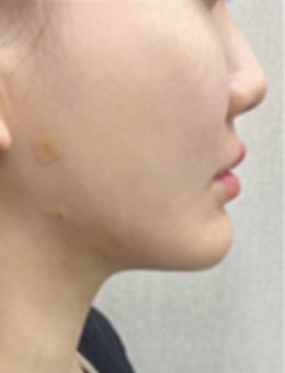 韩国夏恩医院很正规！在韩国口碑也是相当好的一家医院哦！