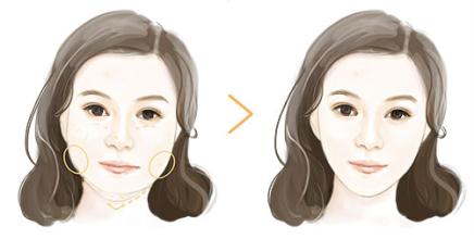国字脸怎么变小脸？韩国面部轮廓整形效果好吗？
