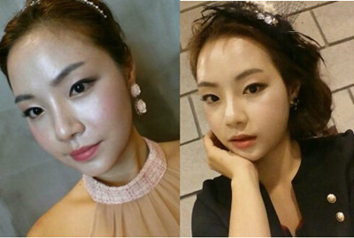 韩国巴诺巴奇脸型恢复第七个月