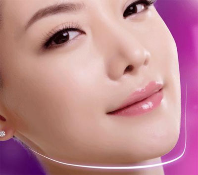 韩国原辰医院做改脸型手术需要多少钱？效果好吗？