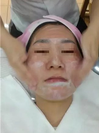 韩国巴诺巴奇皮肤管理术前皮肤清洁