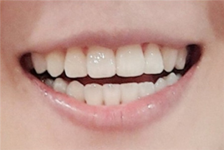 韩国江南美丽微笑牙科牙齿矫正