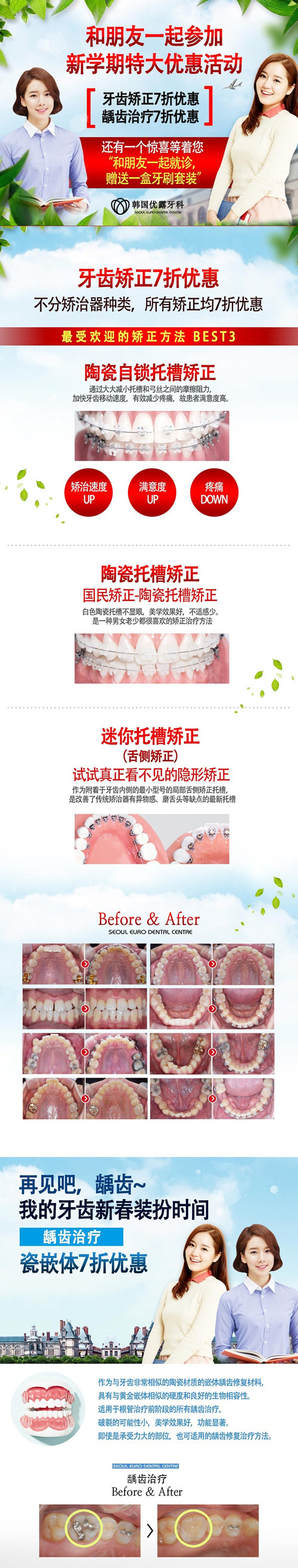 韩国优露整形外科牙齿矫正优惠活动