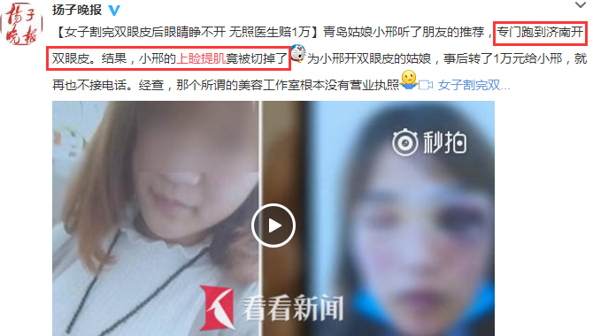 上眼睑提肌科普：风险与手术效果如何权衡？