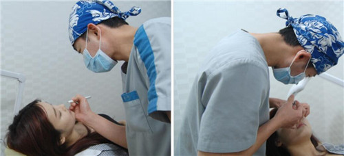 韩国玻尿酸注射隆鼻过程