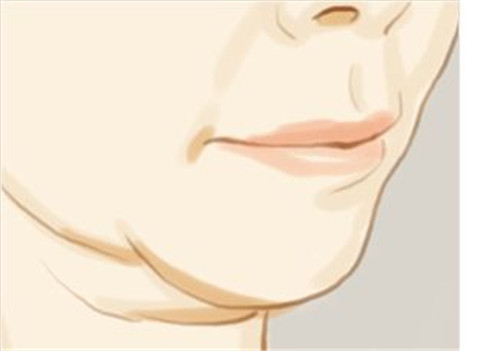 韩国双下巴抽脂手术风险大吗？