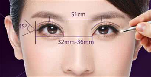 韩式埋线双眼皮一年后双眼皮就消失了吗？