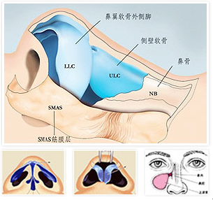 隆鼻解剖图