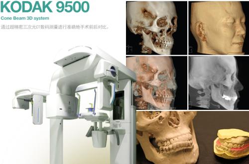 去韩国做轮廓时，为什么医院必须具备3D-CT才靠谱