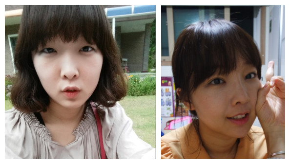 韩国那木和灰姑娘哪家做双眼皮整形比较好呢？