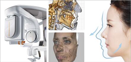 博朗温整形外科3D-CT摄影