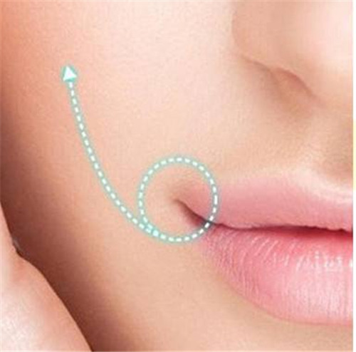 韩国女神医院微笑唇手术优势及案例分享
