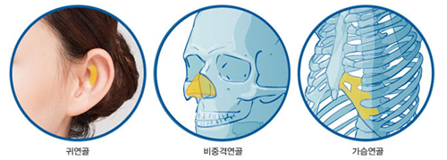 韩国可安美整形外科隆鼻特点分析