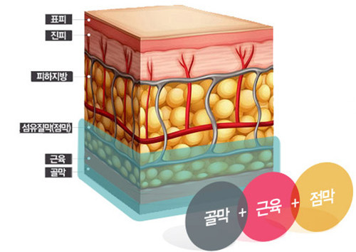 韩国CBK下颌角整形会下垂吗