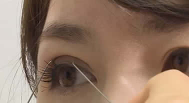 韩国哪些医院做双眼皮技术不错