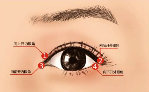 韩国MIGO医院双眼皮手术优势有哪些
