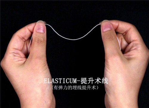 Elasticum弹力纤维线雕提升
