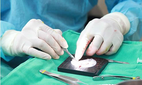 韩国iface整形外科隆鼻手术特点展示