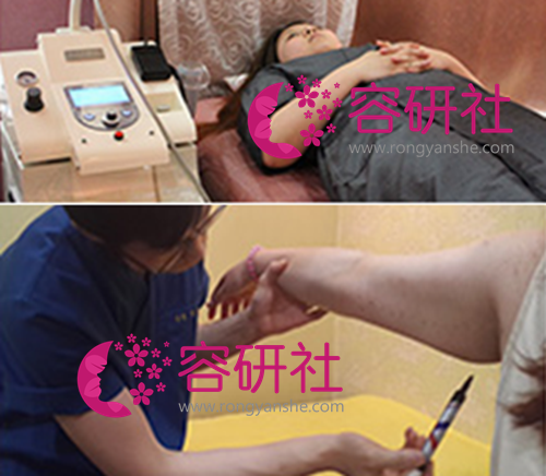 在韩国丽颖整形外科医院吸脂减肥术前检查