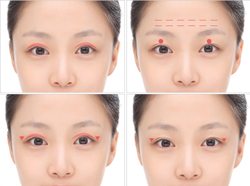 一见整形外科双眼皮手术优势分析