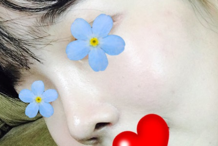 韩国隆鼻整形方案：歌柔飞鲁峰一和trend李俊成日记哪个好