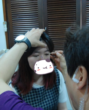 韩国哪家医院做双眼皮修复技术好
