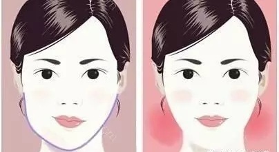 韩国ID整形医院的高技术下颌角矫正，真人日记超酷来袭！