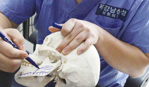 江南三星整形外科下颌角手术优势分析