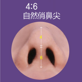 韩国然美之4：6自然鼻尖整形