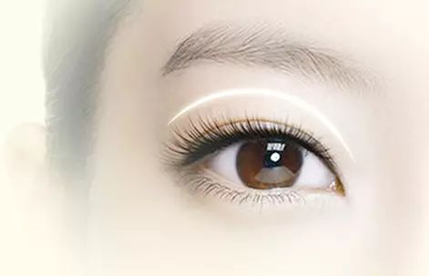 做完双眼皮能做上眼睑下垂矫正吗，韩国医生这么说！
