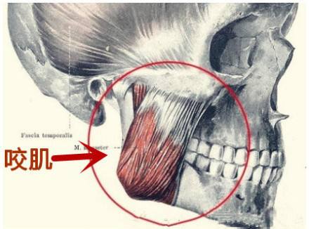韩国原辰医院揭秘：去下颌角要不要顺便去咬肌