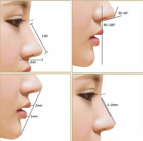 韩式隆鼻设计标准