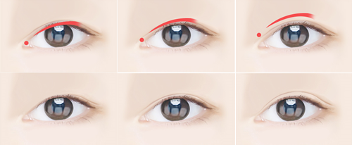 韩国ACE医院双眼皮手术细节分析