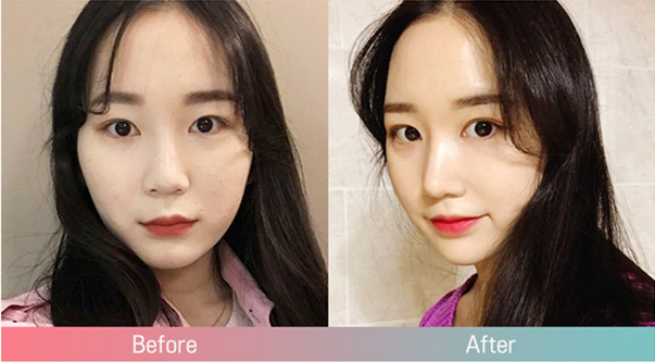 韩国张裕珍整形医生好漂亮，她的整形案例有哪些？