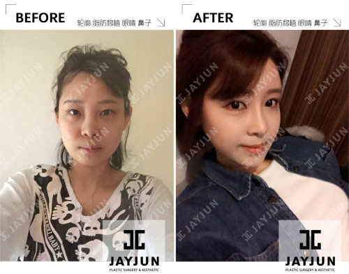 韩国jayjun皮肤管理有什么秘诀，为什么韩国女星在这里保养