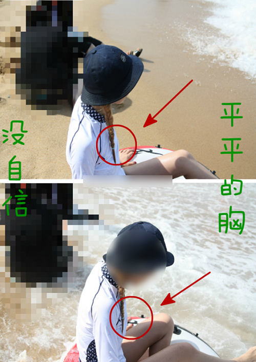 韩国希克丽胸部整形术前照片