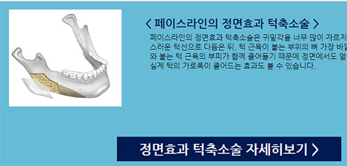 网传韩国菲斯莱茵三件套整形14万，费用虚高齁贵是真是假！