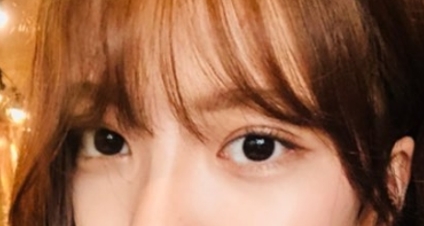韩国蜡笔整形外科双眼皮对比