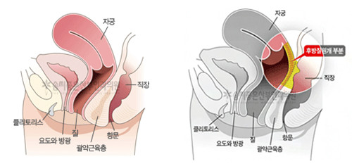 韩国江南有名的整形外科：这些医院私密飘红 阴道紧缩超棒