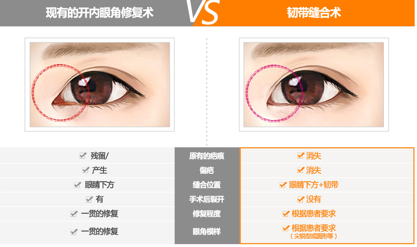 韩国艾源内眼角疤痕修复示意图